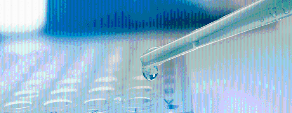 Prueba antígenos, en el laboratorio.