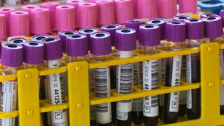 Imagen Actividades de prevención y sensibilización por el Día Mundial del Sida